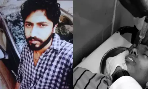 భార్య మొహం పై యాసిడ్ తో దాడి చేసిన భర్త..