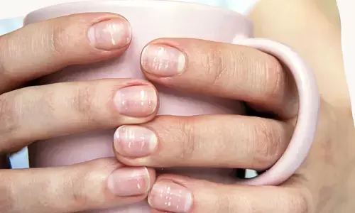 Health Tips : గోర్లపై తెల్ల మచ్చలు.. ఎందుకొస్తాయో తెలుసా?