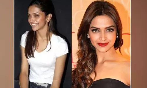 ప్లాస్టిక్ సర్జరీలు చేయించుకోక ముందు Deepika Padukone ఇంత చెండాలంగా ఉందా?