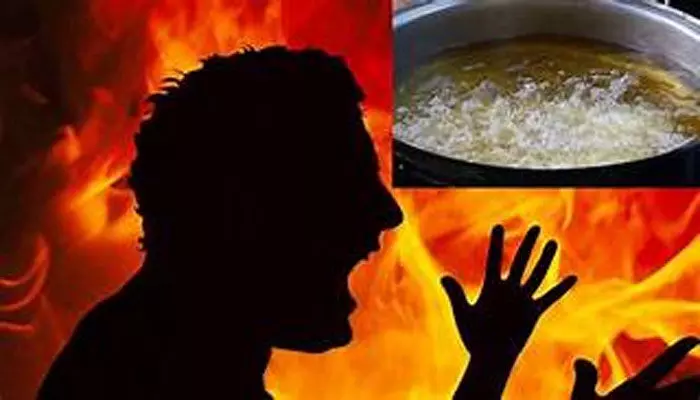 Crime News : భర్తపై సలసల మరిగే నూనె పోసిన భార్య Crime News : భర్తపై సలసల మరిగే నూనె పోసిన భార్య