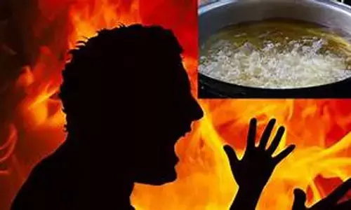 Crime News : భర్తపై సలసల మరిగే నూనె పోసిన భార్య