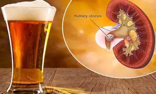 బీర్ తాగితే కిడ్నీలో రాళ్లు పోతాయా? నిపుణులు ఏం చెబుతున్నారంటే..?