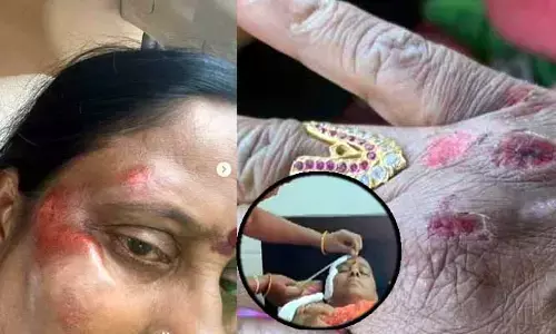రాహుల్ బైక్ ర్యాలీలో అపశృతి.. కొండా సురేఖకు యాక్సిడెంట్