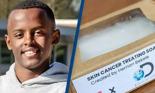 Skin Cancer: సబ్బుతో స్కిన్‌ క్యాన్సర్‌కి చెక్‌.. 14 ఏళ్ల బాలుడి సరికొత్త ఆవిష్కరణ