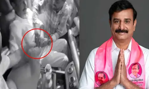 MP ప్రభాకర్‌ రెడ్డి కోలుకోడానికి చాలా టైం పడుతుంది: వైద్యులు