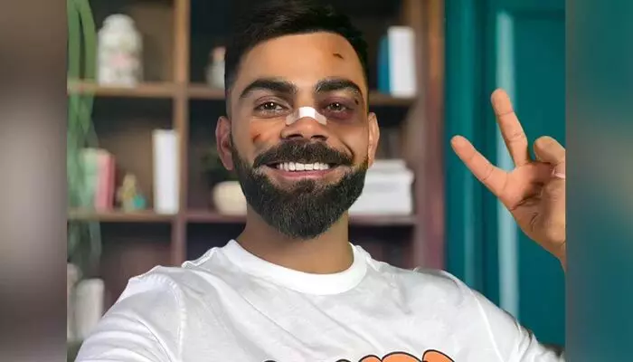 Virat Kohli: ముఖానికి గాయాలు.. ముక్కుపై బ్యాండేజ్.. కోహ్లీకి ఏమైంది..? Virat Kohli: ముఖానికి గాయాలు.. ముక్కుపై బ్యాండేజ్.. కోహ్లీకి ఏమైంది..?