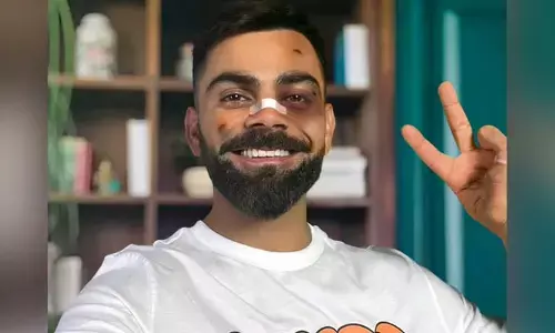 Virat Kohli: ముఖానికి గాయాలు.. ముక్కుపై బ్యాండేజ్.. కోహ్లీకి ఏమైంది..?
