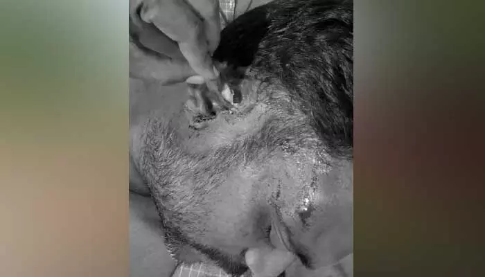 బీఎస్పీ కార్యకర్త పై బీఆర్ఎస్ అభ్యర్థి కోనప్ప అనుచరుల దాడి బీఎస్పీ కార్యకర్త పై బీఆర్ఎస్ అభ్యర్థి కోనప్ప అనుచరుల దాడి