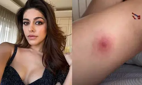 అలయా బట్టల్లో దాక్కుని మరీ అక్కడ అలా చేసిన గెస్ట్.. తీపి గాయంతో..