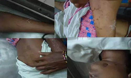 భువనగిరి ఎస్సీ బాలికల హాస్టల్‌ విద్యార్థినిల మృతిలో కొత్త ట్విస్ట్..