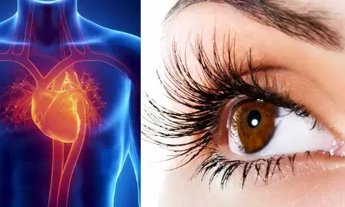 మీ కళ్ళలో మార్పు గమనిస్తున్నారా .. గుండెనొప్పికి సంకేతాలు కావొచ్చు..