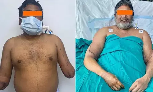 రైలు ప్రమాదంలో తెగిపోయిన రెండు చేతులు.. మరో మహిళ చేతులు అతికించిన వైద్యులు