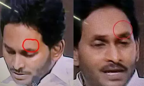 ప్రజల ట్రోలింగ్ దెబ్బకు బ్యాండేజ్ మాయం..నారా లోకేష్ సెన్సేషనల్ కామెంట్స్!