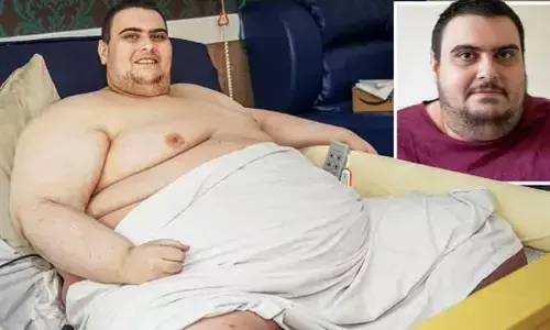 Britains heaviest men: అతి చిన్న వయసులో 317 కిలోల బరువున్న యువకుడు.. చివరికి..?