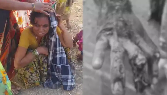 కూలీలతో వెళ్తున్న ఆటో అదుపుతప్పి బోల్తా.. పది మందికి తీవ్ర గాయాలు, ఇద్దరి పరిస్థితి విషమం కూలీలతో వెళ్తున్న ఆటో అదుపుతప్పి బోల్తా.. పది మందికి తీవ్ర గాయాలు, ఇద్దరి పరిస్థితి విషమం