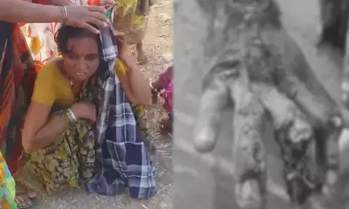 కూలీలతో వెళ్తున్న ఆటో అదుపుతప్పి బోల్తా.. పది మందికి తీవ్ర గాయాలు, ఇద్దరి పరిస్థితి విషమం