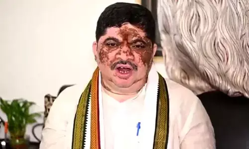Ponnam Prabhakar: రావాల్సిన నిధులనే కేంద్రాన్ని అడుగుతున్నాం: మంత్రి పొన్నం ఆసక్తికర వ్యాఖ్యలు