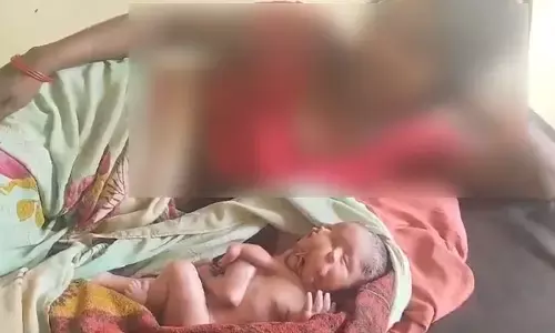 UP: వింత శిశువు జననం!.. నాలుగు కాళ్లు, నాలుగు చేతులతో పుట్టిన పసిబిడ్డ