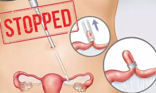 Family Planning: కుటుంబ నియంత్రణ బంద్..! మా వల్ల కాదంటూ చేతులెత్తేసిన వైద్యులు