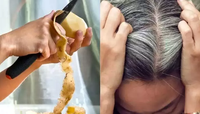 Beauty Tips: తెల్ల జుట్టుతో బాధపడుతున్నారా? బంగాళదుంపతో శాస్వత పరిష్కారం.. ఎలాగంటే? Beauty Tips: తెల్ల జుట్టుతో బాధపడుతున్నారా? బంగాళదుంపతో శాస్వత పరిష్కారం.. ఎలాగంటే?