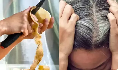 Beauty Tips: తెల్ల జుట్టుతో బాధపడుతున్నారా? బంగాళదుంపతో శాస్వత పరిష్కారం.. ఎలాగంటే?