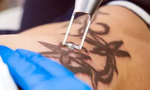 tattoo: బీ అలర్ట్.. టాటూ వేయించుకుంటున్న ప్రతి నలుగురిలో ఒకరికి ఆ సమస్య!