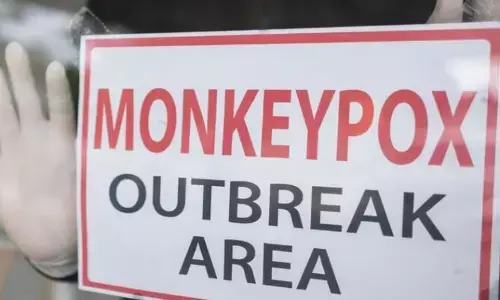 Mpox Outbreak: స్వీడన్‌లో మొదటి మంకీపాక్స్ కేసు నమోదు