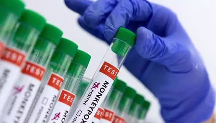Mpox case: భారత్లో మంకీపాక్స్ కేసులు లేవు..కేంద్ర ఆరోగ్య మంత్రిత్వ శాఖ వెల్లడి Mpox case: భారత్లో మంకీపాక్స్ కేసులు లేవు..కేంద్ర ఆరోగ్య మంత్రిత్వ శాఖ వెల్లడి
