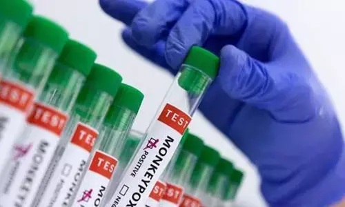 Mpox case: భారత్‌లో మంకీపాక్స్ కేసులు లేవు..కేంద్ర ఆరోగ్య మంత్రిత్వ శాఖ వెల్లడి