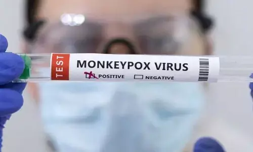 Mpox: పాక్ ఆక్రమిత కశ్మీర్‌లో మంకీపాక్స్ కేసు.. పాకిస్తాన్‌లో నాలుగవది