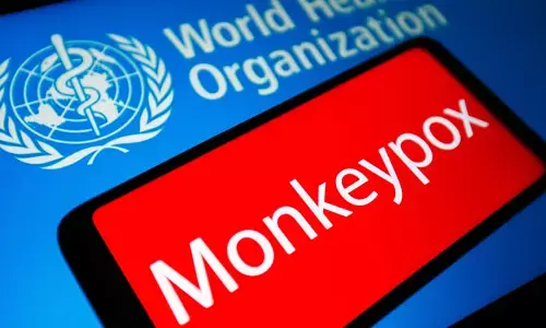 Monkeypox: మంకీపాక్స్‌ కొత్త కొవిడ్ కాదు.. ఎలా నియంత్రించాలో తెలుసు: WHO
