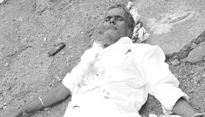 100 కి కాల్ చేసి మరీ కత్తితో పొడుచుకొని ఆత్మహత్యాయత్నం 100 కి కాల్ చేసి మరీ కత్తితో పొడుచుకొని ఆత్మహత్యాయత్నం