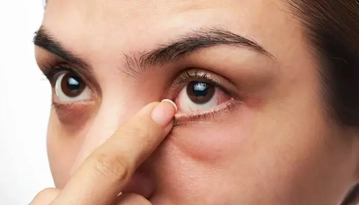 Diabetes : మీకు మధుమేహం ఉందా..? కళ్లల్లో ఈ మార్పులను బట్టి గుర్తించడం ఈజీ! Diabetes : మీకు మధుమేహం ఉందా..? కళ్లల్లో ఈ మార్పులను బట్టి గుర్తించడం ఈజీ!