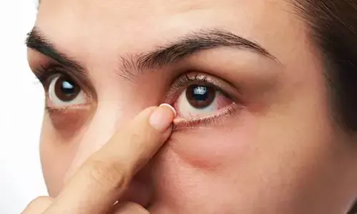 Diabetes : మీకు మధుమేహం ఉందా..? కళ్లల్లో ఈ మార్పులను బట్టి గుర్తించడం ఈజీ!