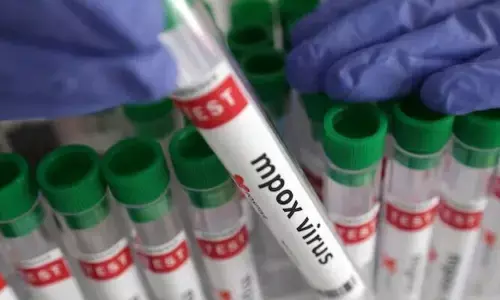 Mpox: భారత్‌లో మొదటి అనుమానాస్పద మంకీపాక్స్ కేసు నమోదు