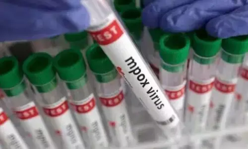 Mpox Vaccine : ఇక పూణేలో మంకీపాక్స్ వ్యాక్సిన్ల తయారీ