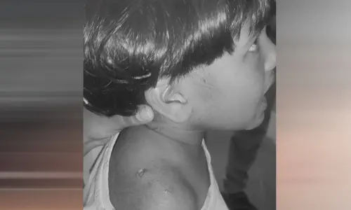 ఆరుబయట ఆడుకుంటుండగా వానర దాడి
