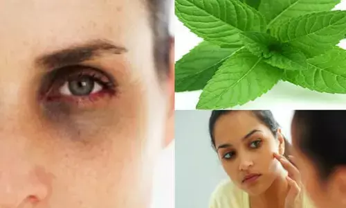 Mint leaves for dark circles : కళ్లచుట్టూ డార్క్ సర్కిల్స్‌.. పుదీనా ఆకులతో ఇలా చేస్తే చాలు !