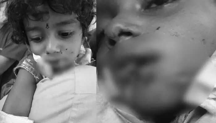 జమ్మికుంట మండలం లో పిచ్చికుక్క స్వైర విహారం జమ్మికుంట మండలం లో పిచ్చికుక్క స్వైర విహారం