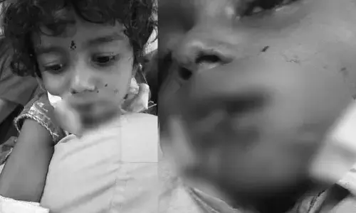 జమ్మికుంట మండలం లో పిచ్చికుక్క స్వైర విహారం