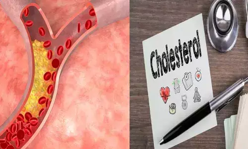 కొలెస్ట్రాల్‌పై అపోహల్లో నిజమెంత..?