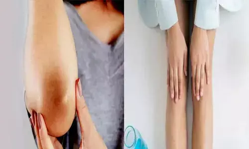 మోకాళ్ల నలుపు పోవాలంటే.. ఈ టిప్స్ పాటించండి..!