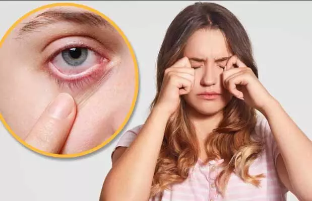 Eye Care Tips : చలికాలంలో కళ్లపై పొల్యూషన్ ఎఫెక్ట్.. వెంటనే రిలీఫ్ కోసం ఏం చేయాలంటే.. Eye Care Tips : చలికాలంలో కళ్లపై పొల్యూషన్ ఎఫెక్ట్.. వెంటనే రిలీఫ్ కోసం ఏం చేయాలంటే..
