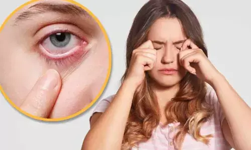 Eye Care Tips : చలికాలంలో కళ్లపై పొల్యూషన్ ఎఫెక్ట్.. వెంటనే రిలీఫ్ కోసం ఏం చేయాలంటే..