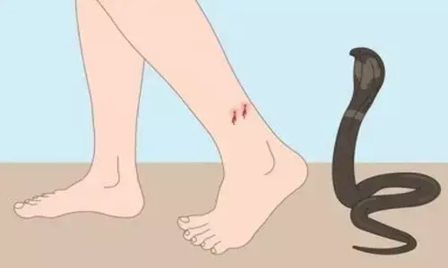 Public Health: పాము కాటు కేసులు నమోదు చేయాలని రాష్ట్రాలకు కేంద్రం లేఖ