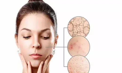 Skin care Tips: ప్యాచీ స్కిన్ పోగొట్టే బెస్ట్ రెమిడీస్..!