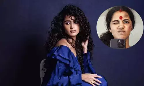 Anupama Parameswaran: ముఖంపై గాయాలతో అనుపమ.. ఆందోళనలో అభిమానులు (పోస్ట్)