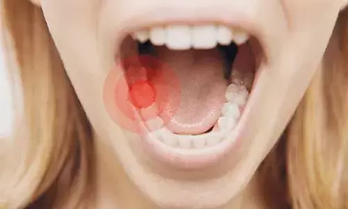 Toothache: కూల్ వెదర్‌ కారణంగా పంటినొప్పి.. ఇలా చేస్తే క్షణాల్లో మాయం!