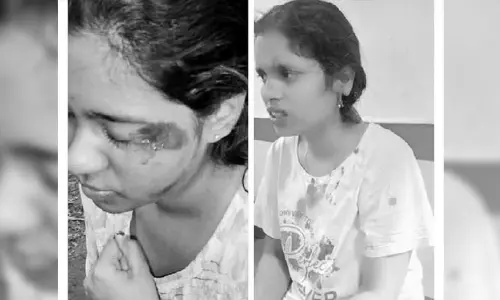 Dog attack: కోఠి ఉమెన్స్ కాలేజీలో విద్యార్థినులపై దాడి చేసిన కుక్క