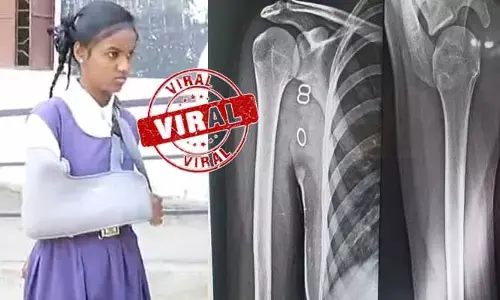 Trending: ప్రభుత్వ పాఠశాలలో అమానుషం.. విద్యార్థిని చెయ్యి విరిగేలా కొట్టిన టీచర్